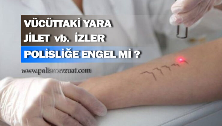 Vücuttaki yaralar, yanık izleri, jilet izleri vb izler polisliğe engel midir?