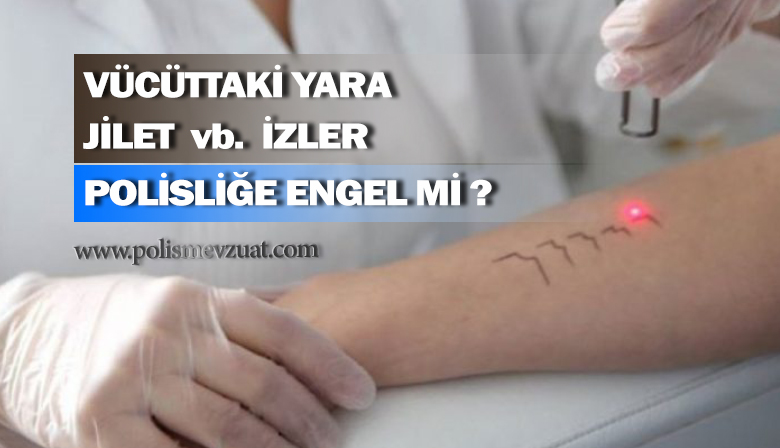 Vücuttaki yaralar, yanık izleri, jilet izleri vb izler polisliğe engel midir?
