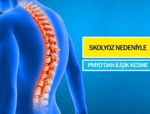 Skolyoz nedeniyle pmyo’dan ilişiği kesilen polis adayı