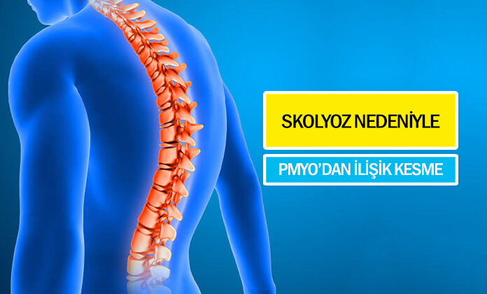 Skolyoz nedeniyle pmyo’dan ilişiği kesilen polis adayı