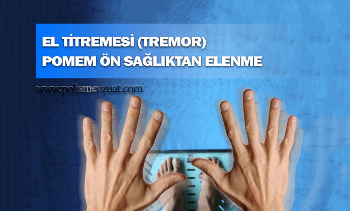 Tremor – el titremesi nedeniyle pomemden ilişiği kesilen adayın kazanılan davasıdır.
