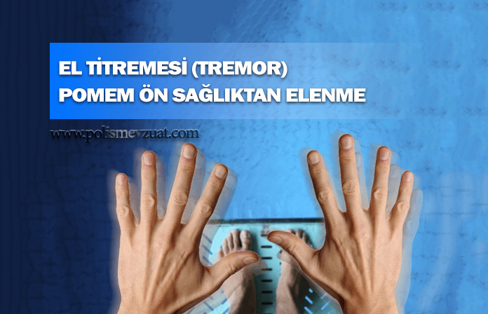Tremor – el titremesi nedeniyle pomemden ilişiği kesilen adayın kazanılan davasıdır.
