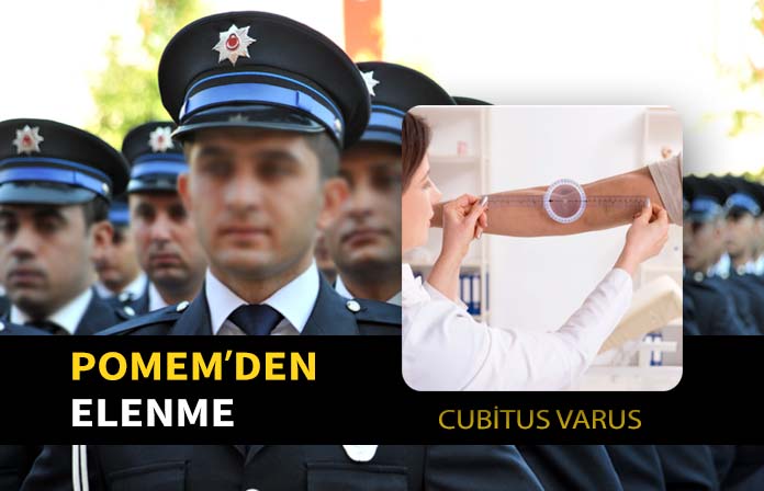 Cubitus varus ön kolun vücuttan açılı olması tanısı ile pomemden elenen adayın davası.
