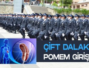 Aksesuar dalak, çift dalak polisliğe engel mi?
