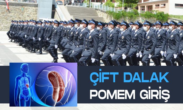 Aksesuar dalak, çift dalak polisliğe engel mi?
